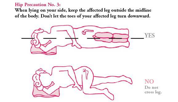 Hip replacement - sleeping position 