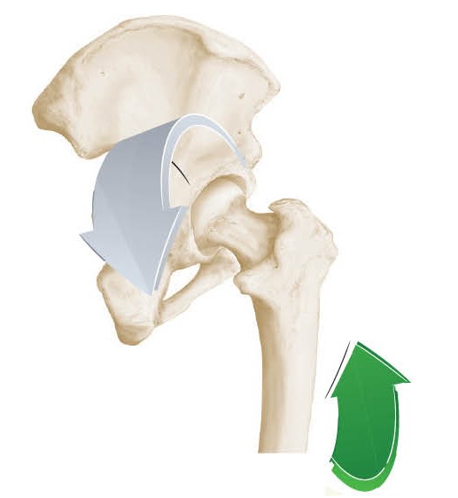 Hip dislocation bringing knees up