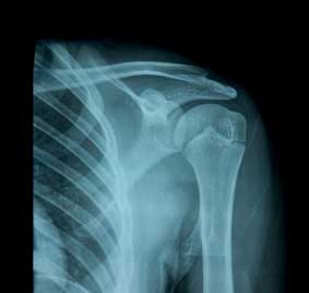 What is the difference between a shoulder girdle and a shoulder joint? -  Quora