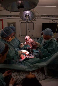 The moment of birth by cesarean.