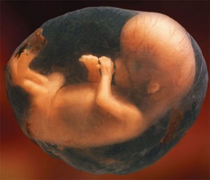 Fetus in amniotic sac