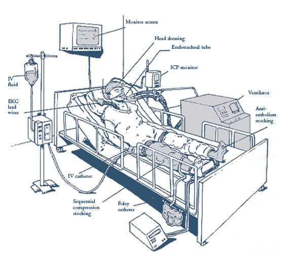 Brain Injury Intensive Care (ICU), monitors, machines, ventilator