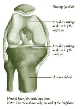 Knee Replacement | Causes, arthritis cartilage, osteonecrosis, injury