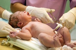 Newborn having umbilical cord clamped.