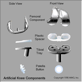 Parts of knee prosthesis