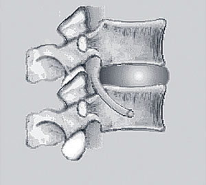 Spinal Segment Spinal Segment