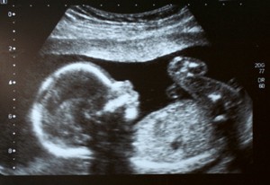 Ultrasound of Baby