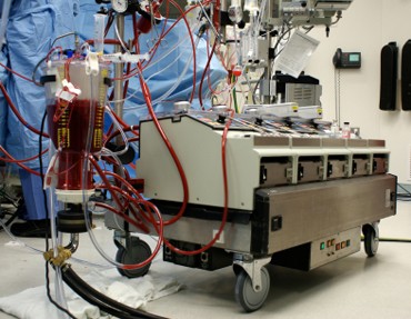 Heart-Lung Machine