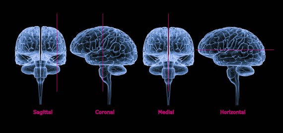 Sectionnement du cerveau