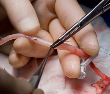 Preparing vein for coronary artery bypass graft Preparing vein for coronary artery bypass graft