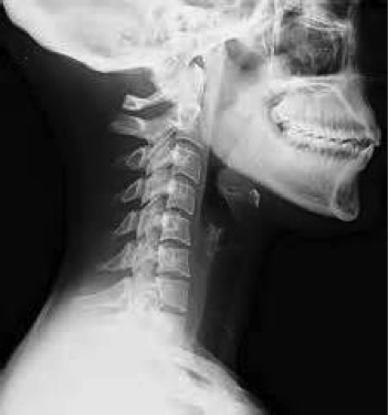 Neck Anatomy Pictures