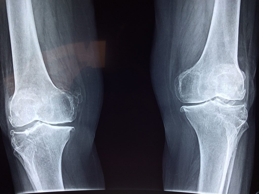 Knees X Ray